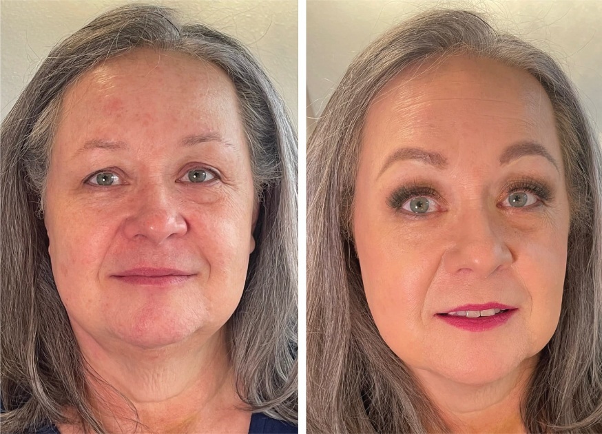 Before-and-after transformation showing a client’s refreshed look at The Honest Image.